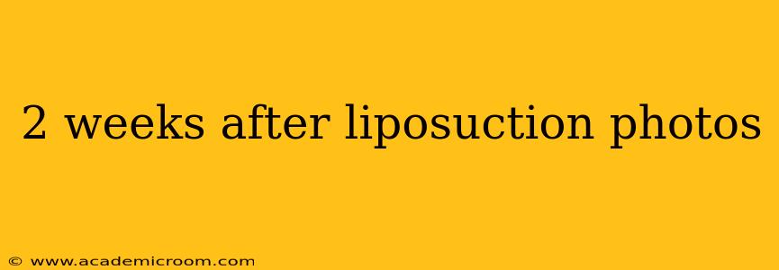 2 weeks after liposuction photos