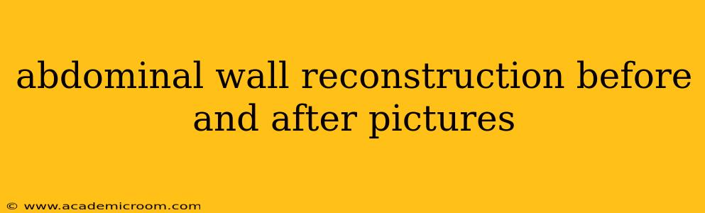 abdominal wall reconstruction before and after pictures