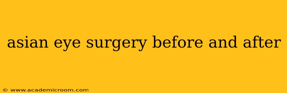 asian eye surgery before and after