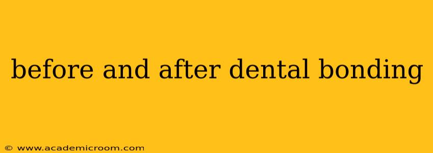 before and after dental bonding