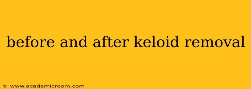 before and after keloid removal