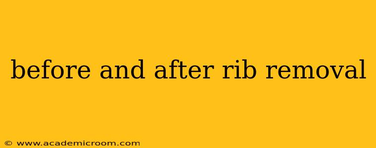 before and after rib removal