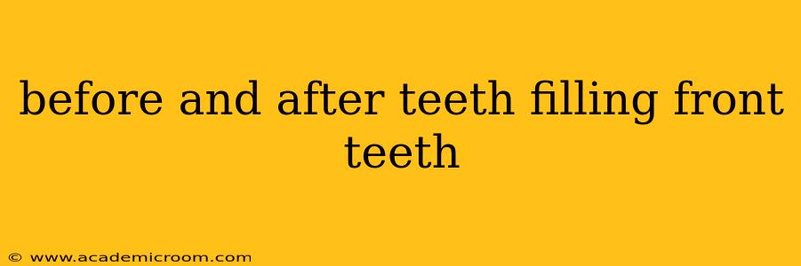 before and after teeth filling front teeth