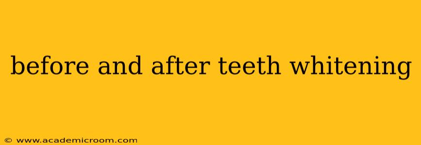 before and after teeth whitening