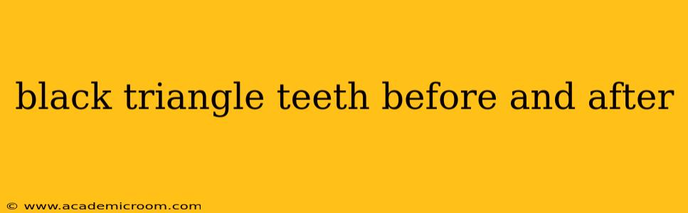 black triangle teeth before and after