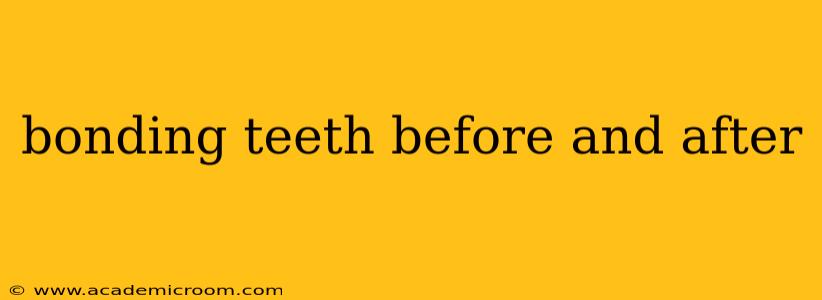 bonding teeth before and after