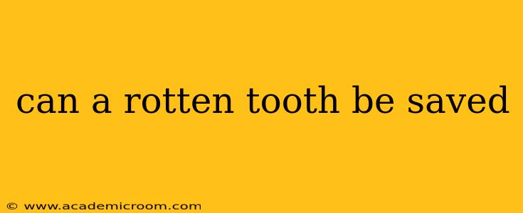 can a rotten tooth be saved
