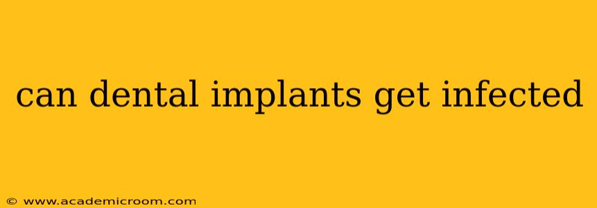 can dental implants get infected