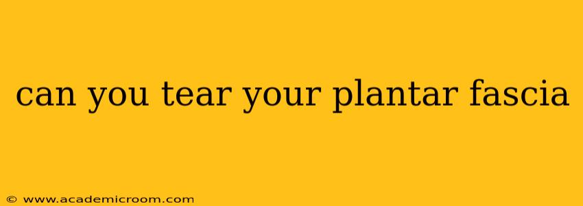 can you tear your plantar fascia