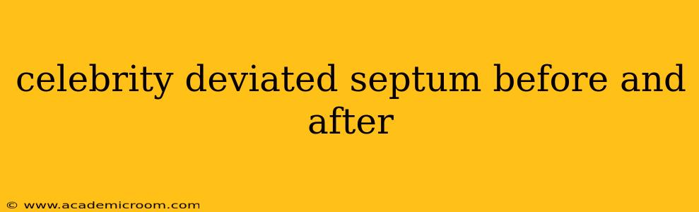 celebrity deviated septum before and after