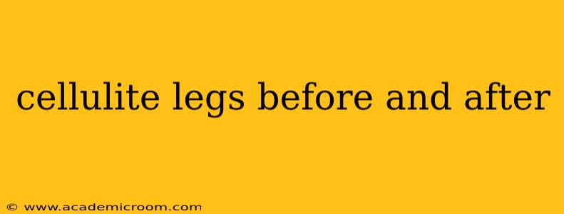 cellulite legs before and after