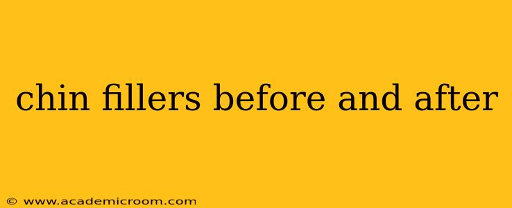 chin fillers before and after