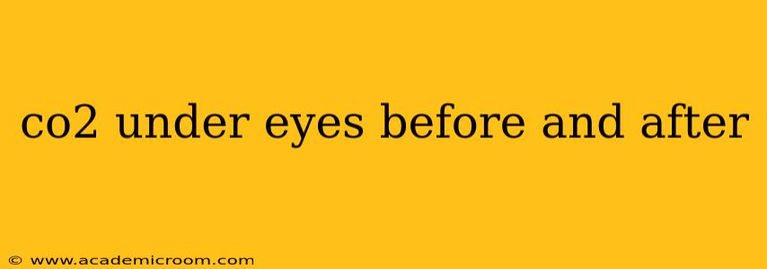 co2 under eyes before and after
