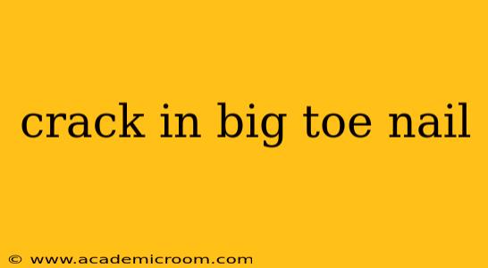 crack in big toe nail