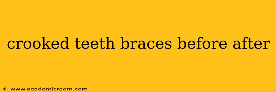 crooked teeth braces before after
