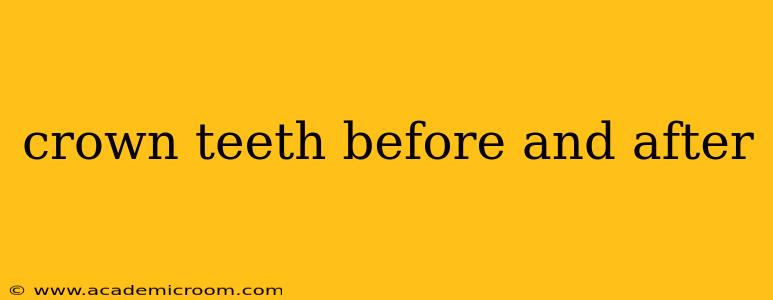 crown teeth before and after