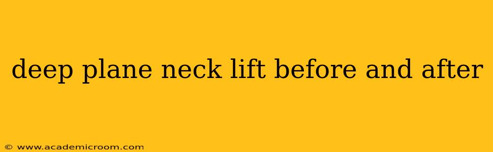 deep plane neck lift before and after