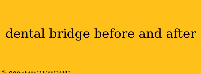 dental bridge before and after