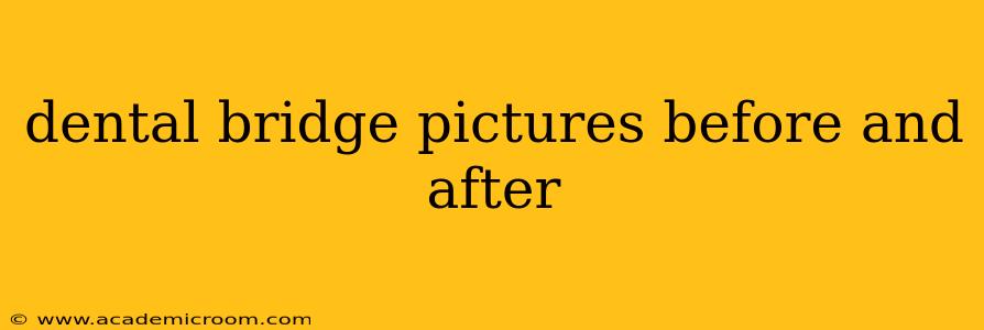 dental bridge pictures before and after
