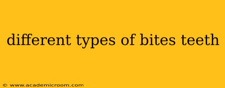 different types of bites teeth