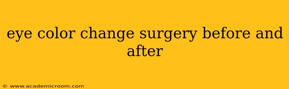 eye color change surgery before and after