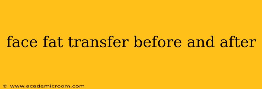 face fat transfer before and after