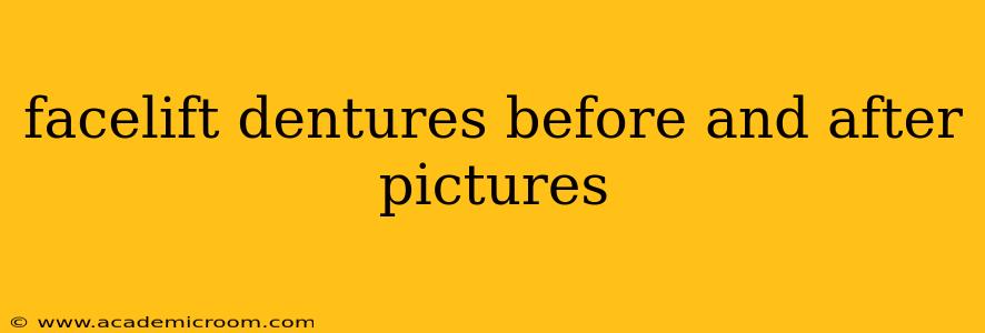 facelift dentures before and after pictures