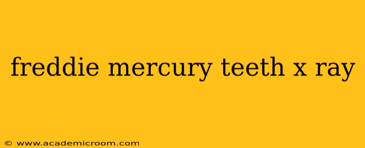 freddie mercury teeth x ray