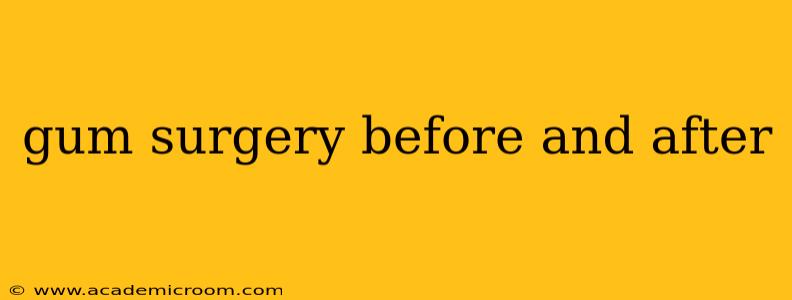 gum surgery before and after
