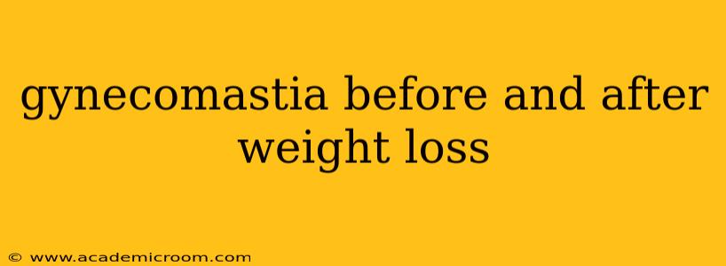 gynecomastia before and after weight loss