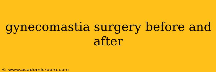 gynecomastia surgery before and after