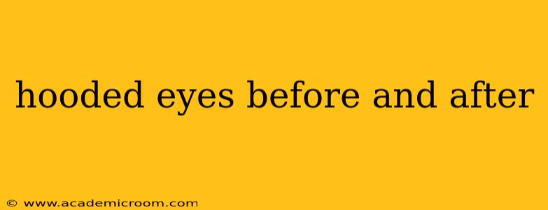 hooded eyes before and after