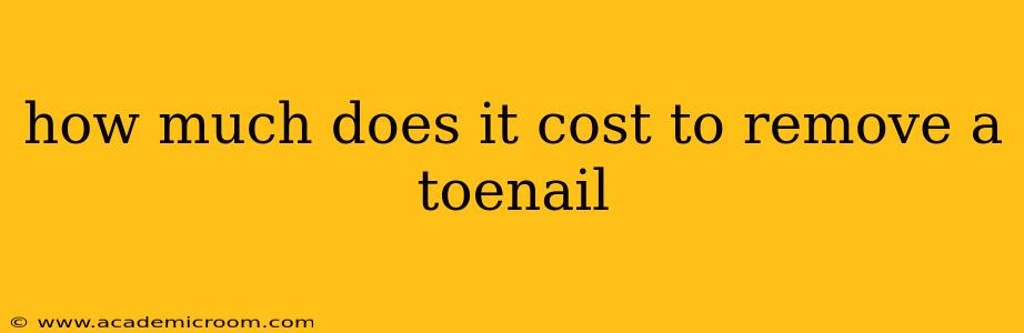 how much does it cost to remove a toenail