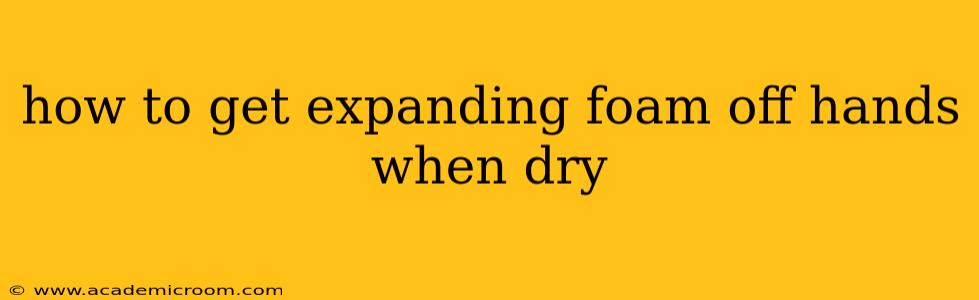 how to get expanding foam off hands when dry