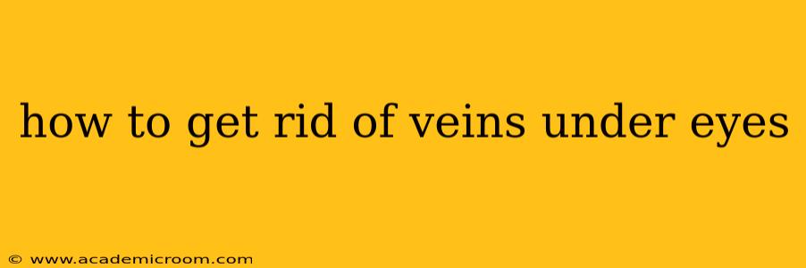 how to get rid of veins under eyes