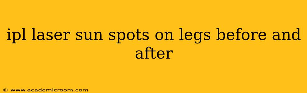 ipl laser sun spots on legs before and after