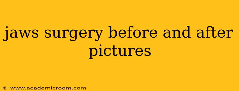 jaws surgery before and after pictures