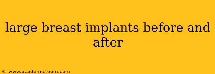 large breast implants before and after