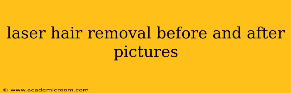 laser hair removal before and after pictures