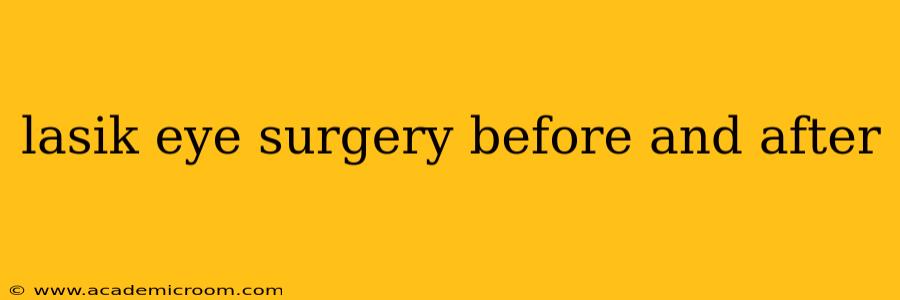 lasik eye surgery before and after