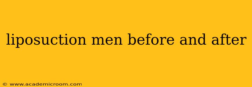 liposuction men before and after