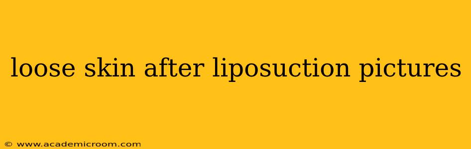 loose skin after liposuction pictures