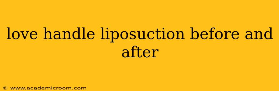 love handle liposuction before and after