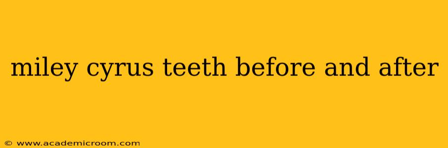 miley cyrus teeth before and after