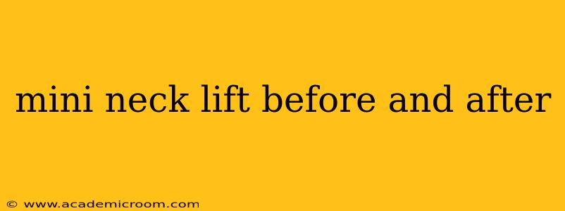 mini neck lift before and after
