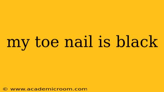 my toe nail is black