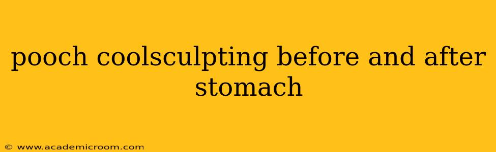 pooch coolsculpting before and after stomach