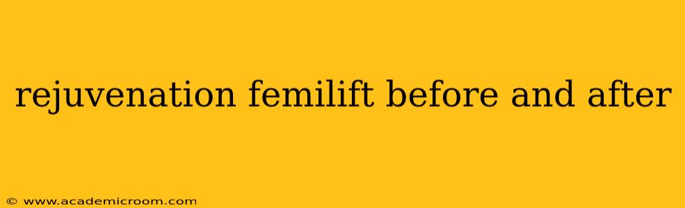rejuvenation femilift before and after
