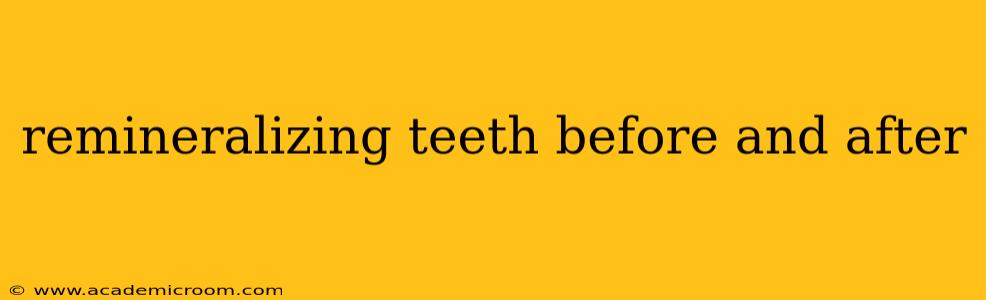 remineralizing teeth before and after