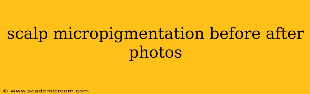 scalp micropigmentation before after photos